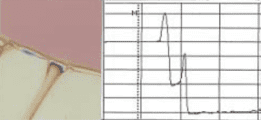 エッジリンス：PGME(1.0秒)